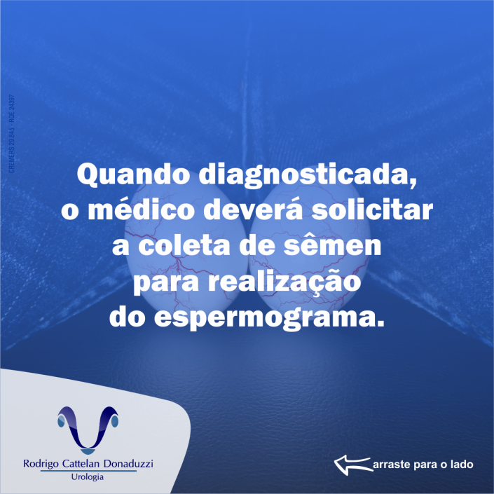 Varicocele Quando Operare E Quando No